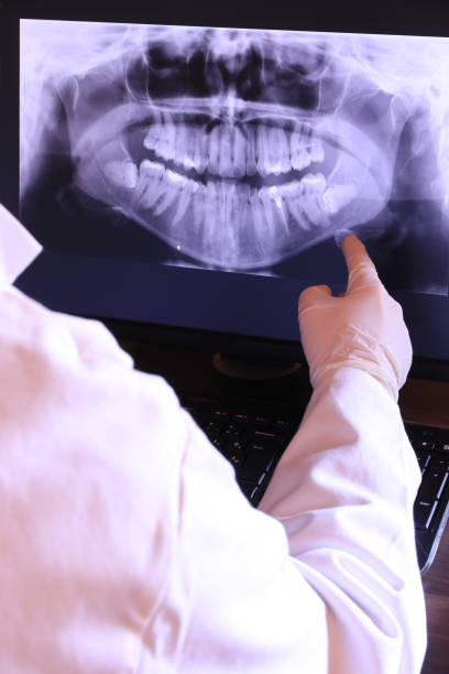 Emergency Dental Filling Replacement in WA